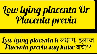 Placenta previa के लक्षण और उपचार Low lying placenta से कैसे बचें [upl. by Malet618]