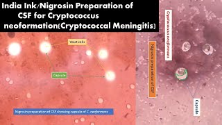 Capsules of Cryptococcus neoformans in India Ink or Nigrosin Preparation of CSF [upl. by Darleen]