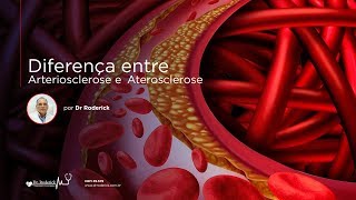 Diferença entre Arteriosclerose e Aterosclerose  Por Dr Roderick [upl. by Lynn666]