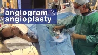 Angiogram amp angioplasty what to expect [upl. by Eilasor822]