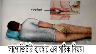 How to use suppository  কিভাবে সঠিক পদ্ধতিতে সাপোজিটরি ব্যবহার করবেন  khan pharmacy [upl. by Leunas]