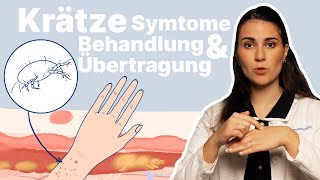 Krätze erkennen amp behandeln Was hilft bei infizierten Möbeln │Dr med Alice Martin [upl. by Ysteb]