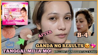 Brilliant Skin Essentials Rejuvenating Set Review for 30days PAK NA PAK BESH [upl. by Behlau]