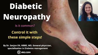 Diabetic Neuropathy foot pain Symptoms Causes Treatment amp Control [upl. by Zashin]