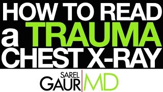 How to Read a Trauma Chest Xray in 3 Minutes [upl. by Oicneconi]