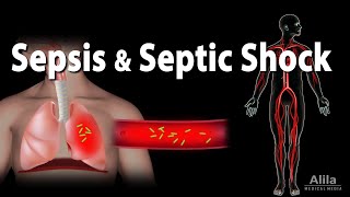 Sepsis and Septic Shock Animation [upl. by Llenrup]