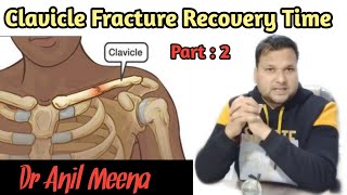 Clavicle bone fracture recovery time  clavicle bone Fracture treatment  collar bone  in hindi [upl. by Formenti962]