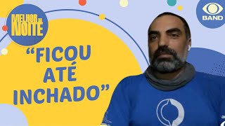 EITA Repórter do Melhor da Noite é picado por marimbondo ao vivo [upl. by Irtimed599]