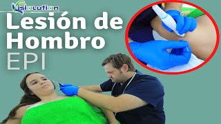 TRATAMIENTO EPI del HOMBRO LESIONADO Fisioterapia  Fisiolution [upl. by Hamachi803]