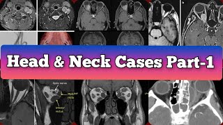 Radiology Viva Cases  367 375  Head and Neck Exam Cases Part 1 medical radiology [upl. by Andie112]