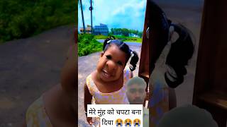 Misty ka मुंह चपटा कैसे हो गया shorts funny comedy love emotional chocolate misty [upl. by Adnowat100]