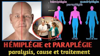 Santé Hémiplégie et Paraplégie  Maladies et les remèdes 😷 tawat yi ak saafara yi wolof [upl. by Leiuqeze284]