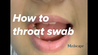 How to perform a throat swab on a patient [upl. by Eeryk667]