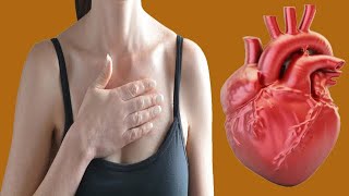 Heart Palpitation Treatment And Home Remedies [upl. by Nimar394]