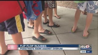 Experts warn against wearing flipflops every day [upl. by Barbur]