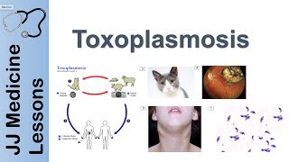 Toxoplasmosis  Acquired vs Congenital  Signs Symptoms Diagnosis and Treatment [upl. by Husein]