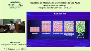 Neoplasia Biologia dos Tumores [upl. by Christenson]