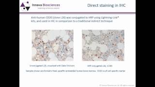 Immunohistochemistry Webinar An Introduction to Immunohistochemistry [upl. by Refitsirhc705]