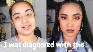 Going to Therapy My diagnosis CHIT CHAT GRWM KissedByKen [upl. by Eladnar315]