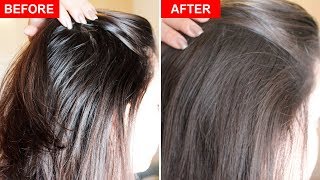 How To Fix Greasy Hair Naturally [upl. by Eirdua]