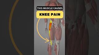 🎥 Understanding Lateral Knee Pain The Muscle Dysfunction You Can’t Ignore [upl. by Junia]