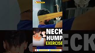 Neck hump exercises treatment neckpain hump viral facts hack [upl. by Hanas]