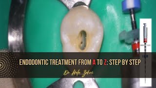 Root canal treatment from A to Z Step by Step [upl. by Olsewski]