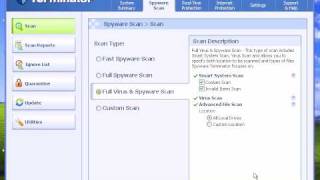 Spyware Terminator Detection and Removal Review Part 1 [upl. by Bick]