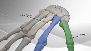 Thumb Metacarpal Arthritis Repair with Arthrex® CMC Mini TightRope® [upl. by Upali]