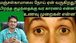 What is jaundiceformation of bilirubininfant jaundiceamptheir diet explanation in tamil jaundice [upl. by Samanthia]