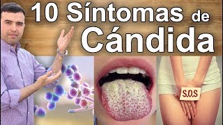 Síntomas Y Signos Que Indican Que Tienes Candidiasis  10 Síntomas Que No Debes Ignorar [upl. by Bough]