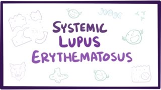 Systemic lupus erythematosus SLE  causes symptoms diagnosis amp pathology [upl. by Lange]