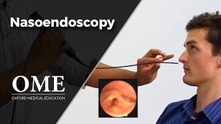 Nasoendoscopy Nose Examination  ENT [upl. by Udella594]