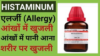 एलर्जी  खुजली आंखों में खुजली  की होम्योपैथिक मेडिसिन  Histaminum Hydrochloricum  Health [upl. by Ennaerb]