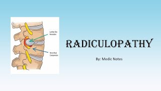 Radiculopathy vs radicular pain risk factors clinical features red flag symptoms treatment [upl. by Lincoln]