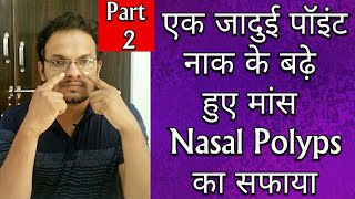 Single Acupressure Point For NASAL POLYPS In Hindi  One Point To Cure Nasal Polyps  2 [upl. by Ellatnahc]