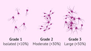 Mixed Agglutination Reaction MAR Test  semenhealth semen analysis fertility fertilitytest [upl. by Mencher]