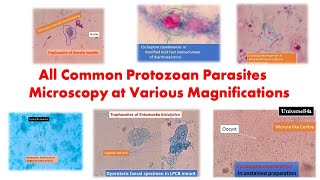 All Common Protozoan Parasites under the Microscope GiardiaAmoeba TrichomonasCyclosporaCryptosp [upl. by Annor]