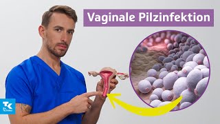 Vaginale Pilzinfektion verstehen Ursachen Symptome Diagnose amp Therapie  DocTommy [upl. by Edora]