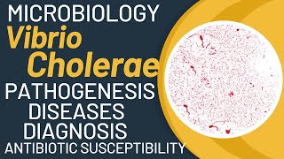 Vibrio cholerae cholera  Vibrio cholerae microbiology  Pathogenesis lab diagnosis [upl. by Ram368]