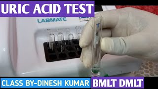 Uric Acid Test Practical Video  Uric Acid Test Principle Procedure by Semiautomatic Analyser [upl. by Rehpotsihrc542]