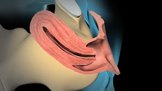 Dilation and Curettage D amp C [upl. by Naehs]