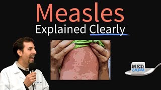 Measles rubeola Explained Clearly by MedCramcom [upl. by Manard]