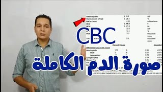 CBC ازاى تقرا تحليل صورة الدم الكاملة [upl. by Lassiter669]