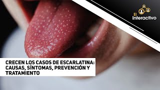 Crecen los casos de escarlatina causas síntomas prevención y tratamiento [upl. by Brinn]