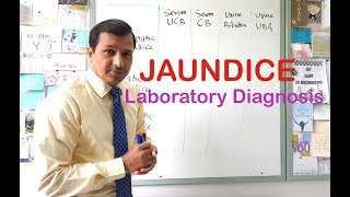 Jaundice  Laboratory Diagnosis [upl. by Viens772]