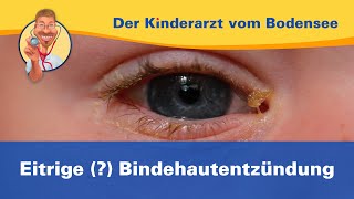 Eitrige  Bindehautentzündung — Der Kinderarzt vom Bodensee [upl. by Jessalin]