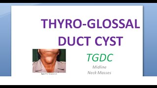 ENT ThyroGlossal Duct Cyst TGDC Neck swelling bump lump swollen midline middle center Sistrunk [upl. by Ahsinac]