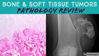 Bone amp Soft Tissue Pathology Board Review 21 Classic Cases [upl. by Htedirem]