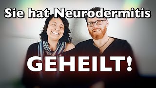 Neurodermitis geheilt 👀 Multiple Transformation der Nathalie ❤️ [upl. by Anhavas]